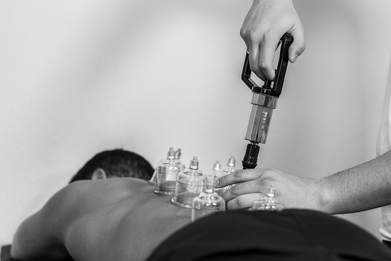 Aupuncturist performs massage cupping therapy